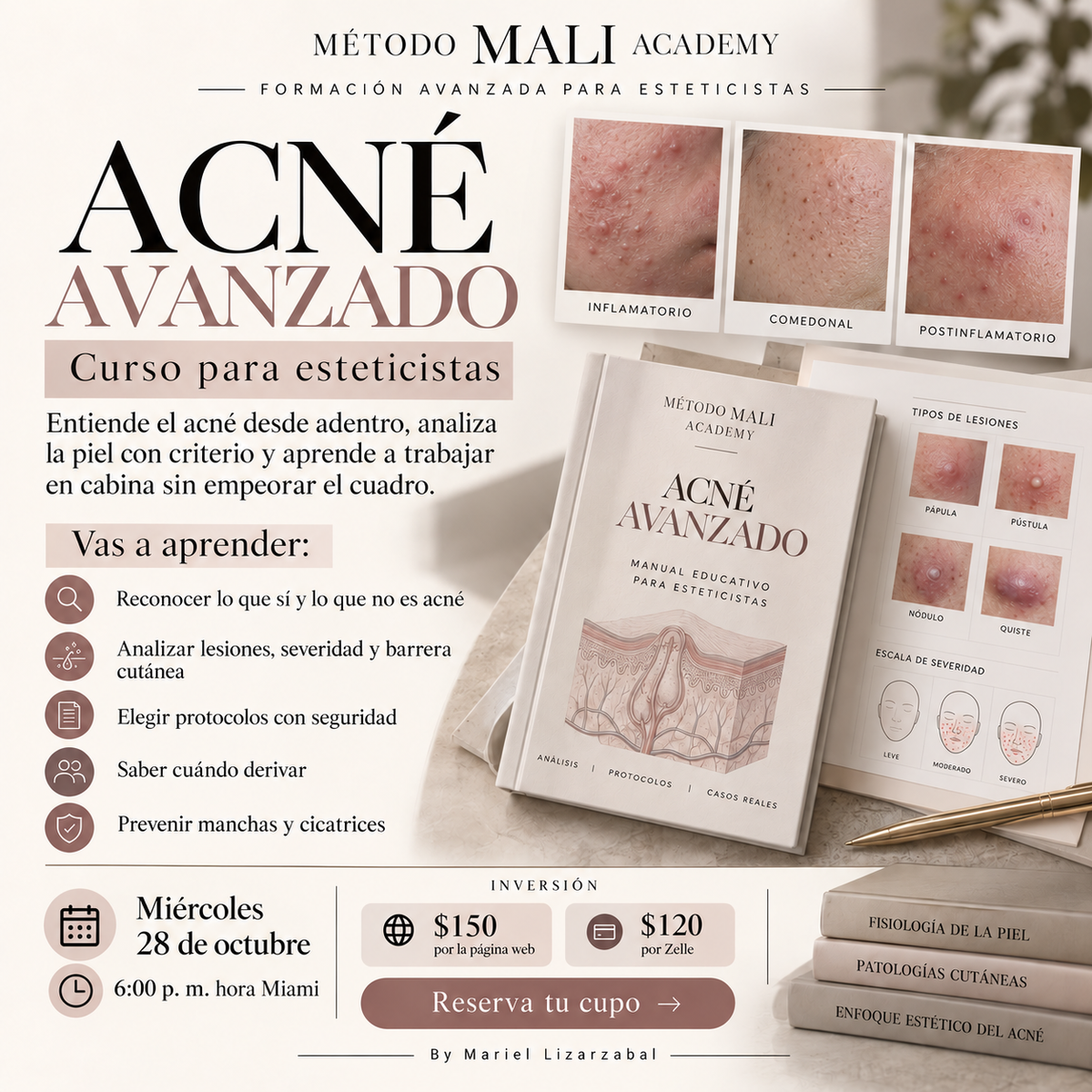 Acné Avanzado