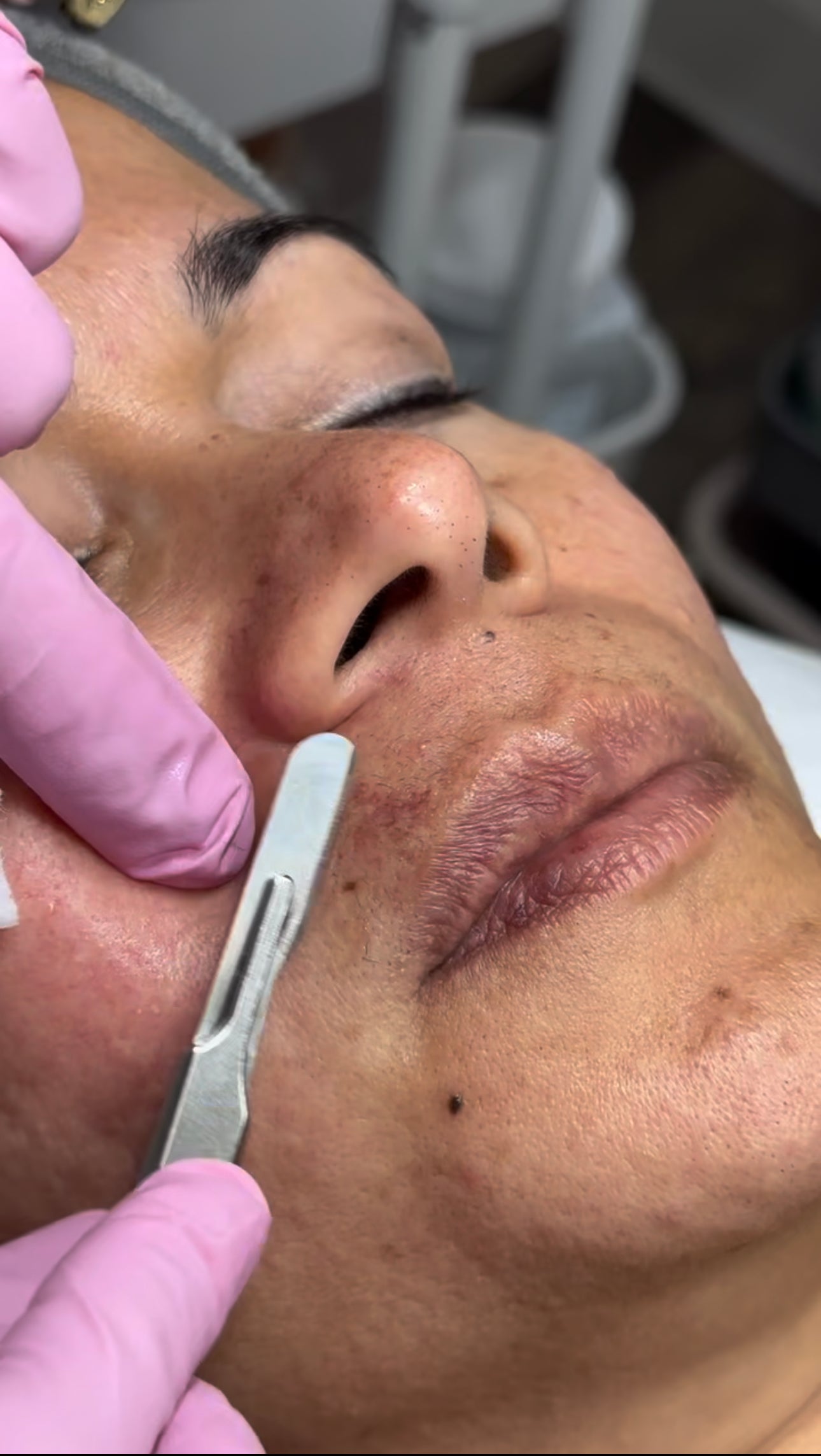 Capacitación Online Dermaplaning |