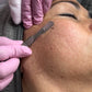 Capacitación Online Dermaplaning |