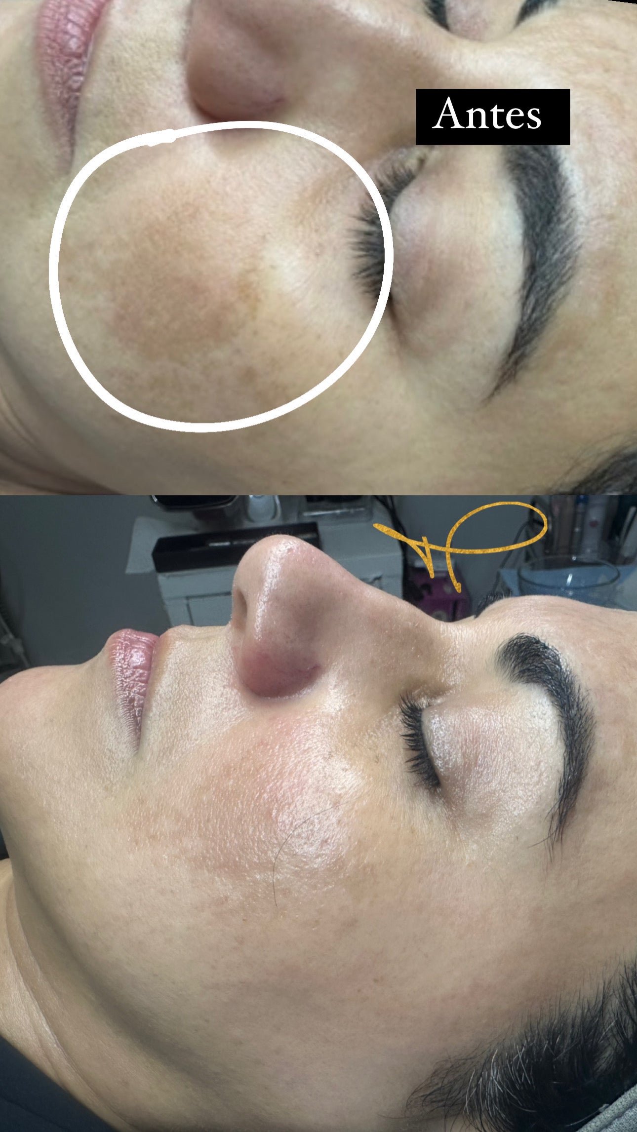 CLASE PROFESIONAL DE PEELING ESTÉTICO

Domina el peeling con criterio, seguridad y resultados reales