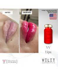 Capacitación Online Hidra Lips + VV Lips | PRÓXIMAMENTE