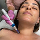 Capacitación Online Microneedling o Microagujas |